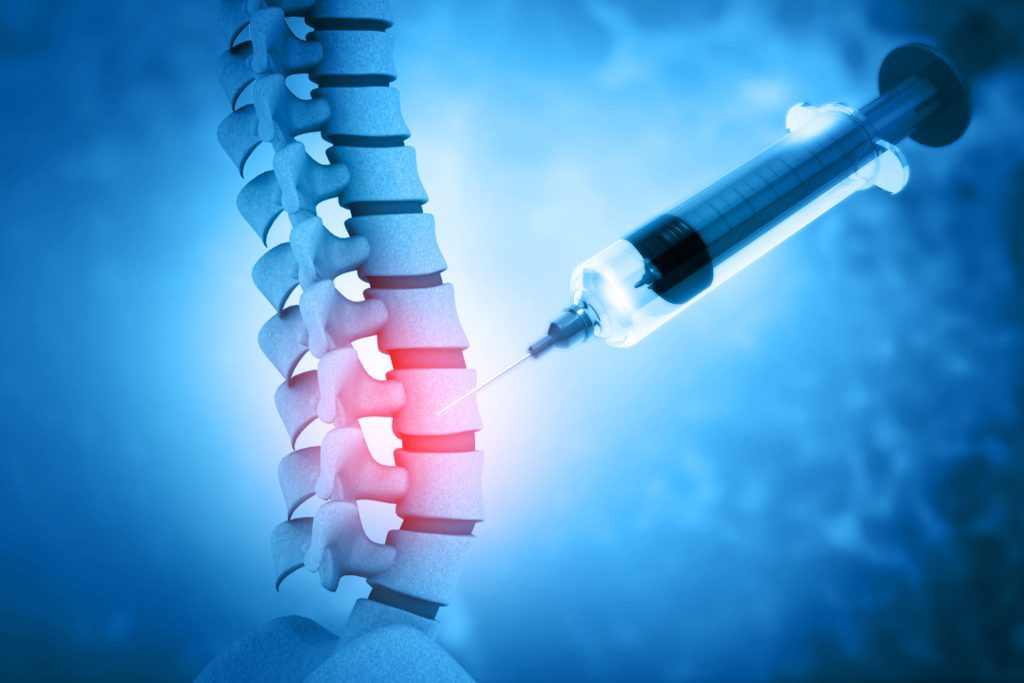 Are Spinal Injections Safe? Pain Control Associates, LLC Chronic